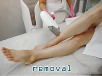 Định nghĩa & cách phát âm từ removal