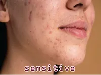 Định nghĩa & cách phát âm từ sensitive